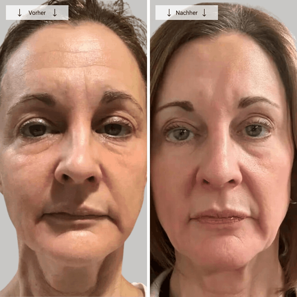 ADOURÉE LED Maske